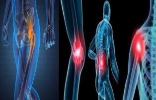 Tratament natural pentru durerile articulare