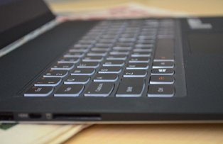 Un adolescent si-a taiat mana pentru a scapa de dependenta de Internet. Inainte de asta i-a scris mamei un bilet
