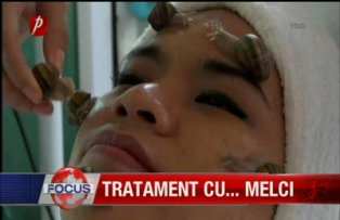 Tratament cu melci
