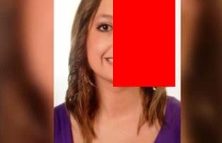 Sufera de o boala rara care ii topeste jumatate din fata. Cum arata tanara de 22 de ani