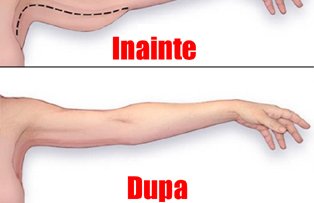 Cum sa scapi de grasimea depusa pe brate