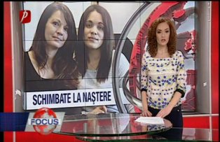 Schimbate la naştere