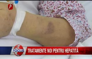 Tratamente noi pentru hepatita