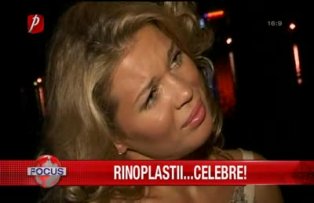 Rinoplastii celebre