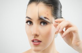 Ai puncte negre? Remediul care te scapa de toate problemele tenului