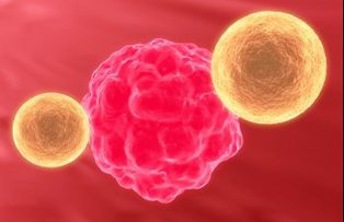 Tratament revolutionar contra cancerului, chiar si in faze terminale