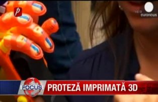 Proteză imprimată 3D
