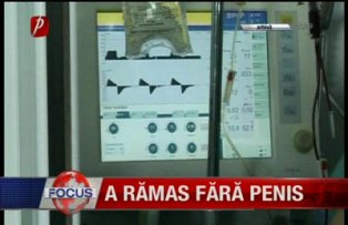 A ramas fara penis