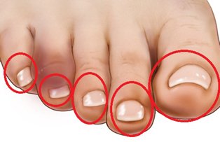 Atinge-ti varfurile degetelor de la picioare si vei afla daca ai sau nu probleme cu inima