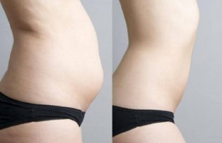 Fa asta si in 7 zile veti scapa de grasimea de pe abdomen
