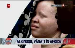 Albinosii vanati in Africa