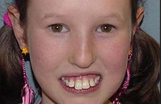 In scoala era batjocorita, insa ACUM e complet schimbata. Cum arata dupa un tratament dentar