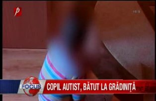 Copil autist batut la gradinita