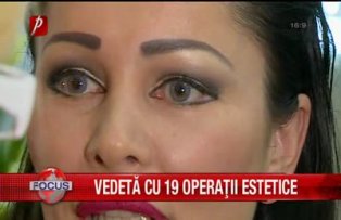 Vedeta cu 19 operatii estetice