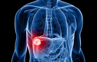 Semne clare care arata ca ai probleme cu ficatul! Cum se transforma corpul tau