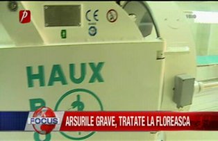 Arsurile grave tratate la Floreasca