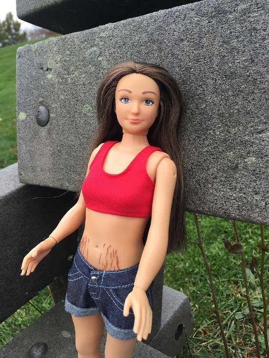 Păpuşa Barbie are mai nou celulită, vergeturi şi acnee! Vezi cum arată creaţia lui Nickolay Lamm!