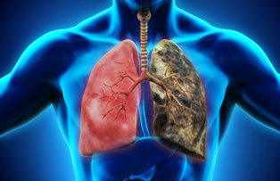 Acest remediu natural ajuta fumatorii sa-si curete plamanii