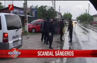 Scandal sangeros