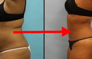 Obtine un abdomen plat in numai 7 zile. Ce trebuie sa faci