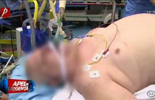 VIDEO / Momente de cumpana la "Apel de urgenta". Medicii nu-i dau mari sanse de supravietuire unui barbat aflat in stop cardiorespirator