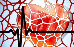 Asa scazi tensiunea arteriala fara pastile